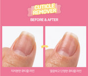ABLLIZ Cuticle Remover
