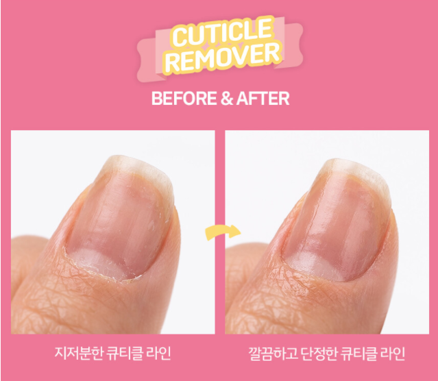 ABLLIZ Cuticle Remover