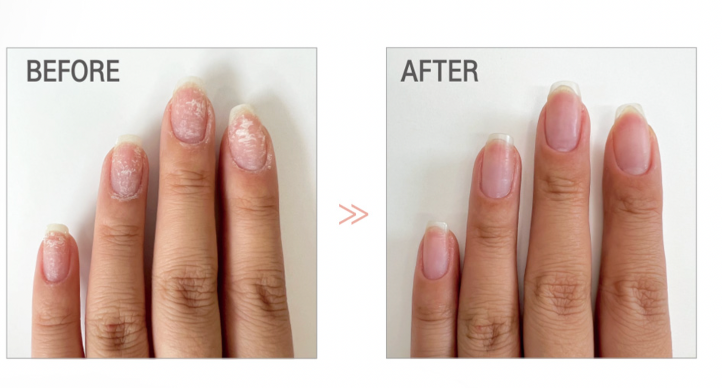 GENTLE PINK First step nail repair solution - 5ml bonus roll-on included