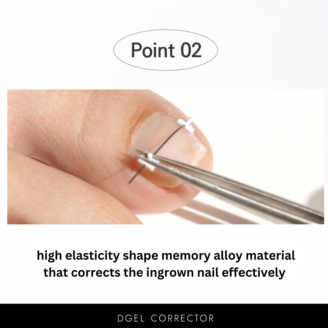 DGEL CORRECTOR - for ingrown nails